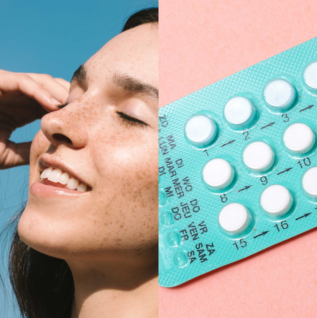 Opinion: Healing my inflamed, acne-ridden skin after coming off the  contraceptive pill